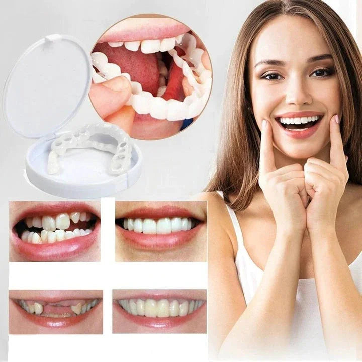 Cosmetische snap-on tanden voor een snelle tanden correctie en stralend, natuurlijk gebit.