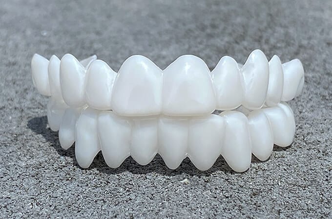 Close-up van de verstelbare cosmetische tandprothese, ideaal voor een perfect gebit.