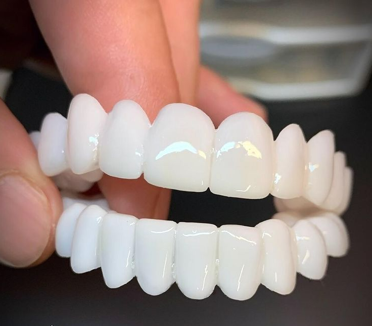 Verstelbare cosmetische tandprothese voor een stralende, witte glimlach en meer zelfvertrouwen.