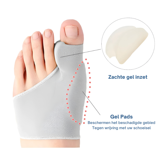 Effectieve bunion corrector met gelpad, ontworpen om hallux valgus te scheiden en voetpijn te verminderen.