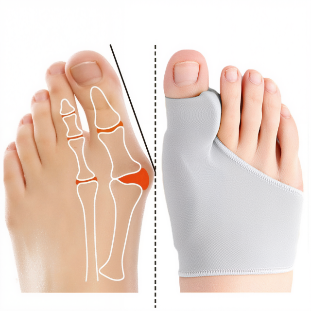 Medische teenseparator met zachte gelpad voor gezonde voeten, helpt bij bunions, hallux valgus en algemene voetpijn.